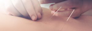 BodyKore Monaghan - Acupuncture